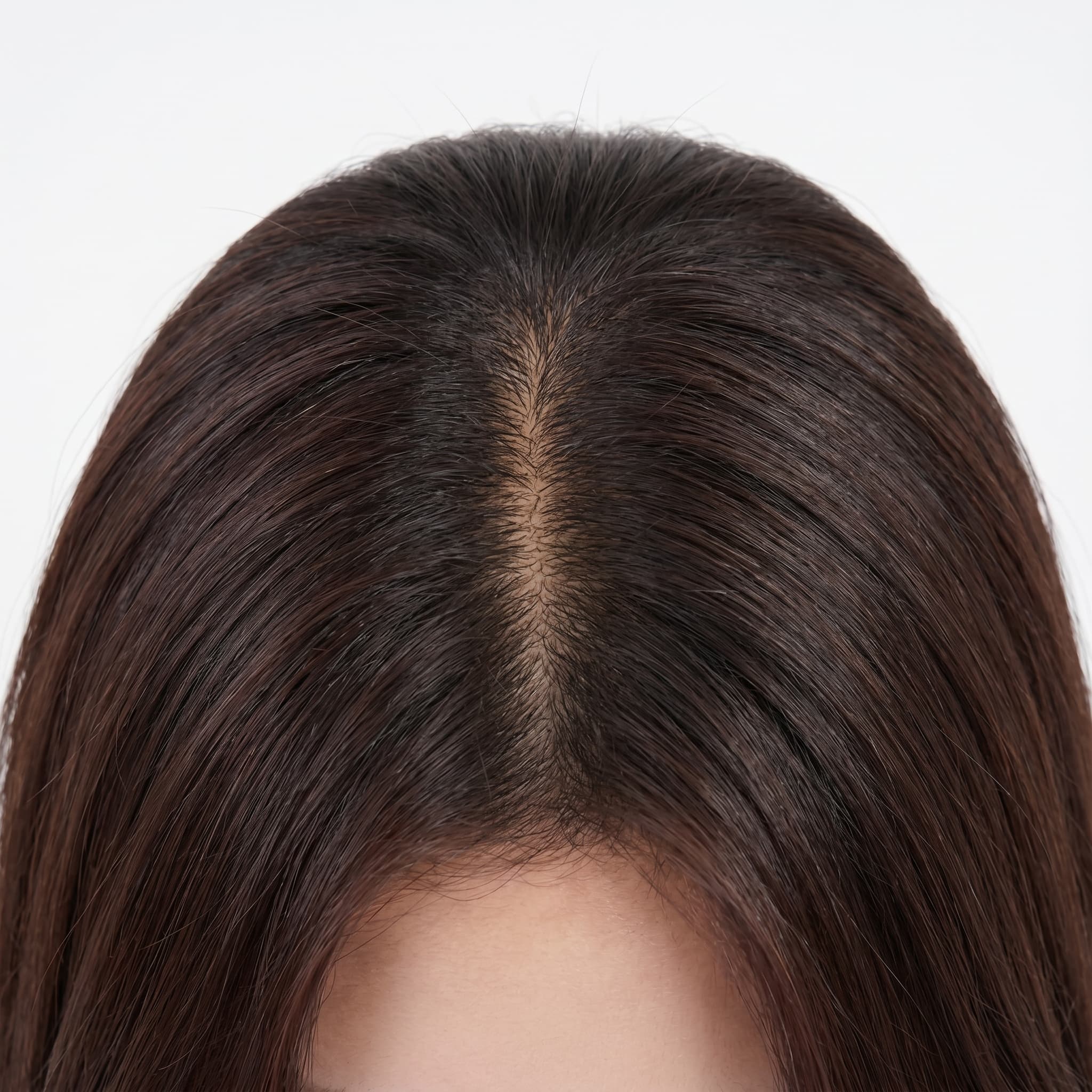 Hair Loss and Scalp Care: Combining Medication With Clinic Treatment